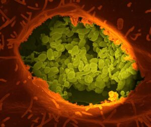 Fever and Fatigue A Common but Often Misunderstood Combination in Viral Illness