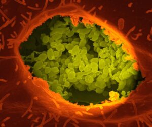 Why Do Some Infections Cause Fevers While Others Do Not